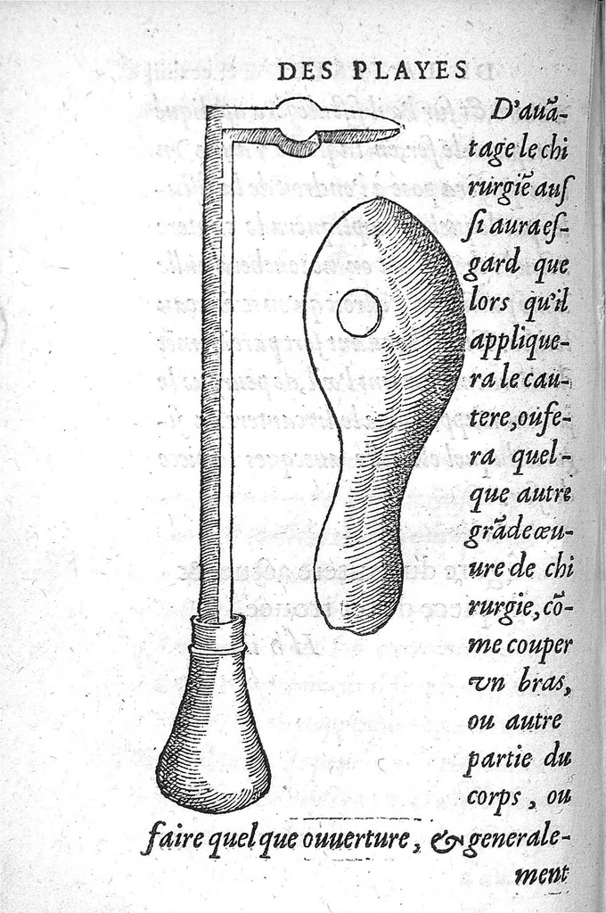 An illustration from La Methode Curative des Playes et Fracture de la teste humaine. Avec les pourtraits des Instruments necessaires pour la curation d’icelles. Par M. Ambroise Paré Chirurgien ordinaire du Roy, et Juré à Paris,, 1561, leaf 511