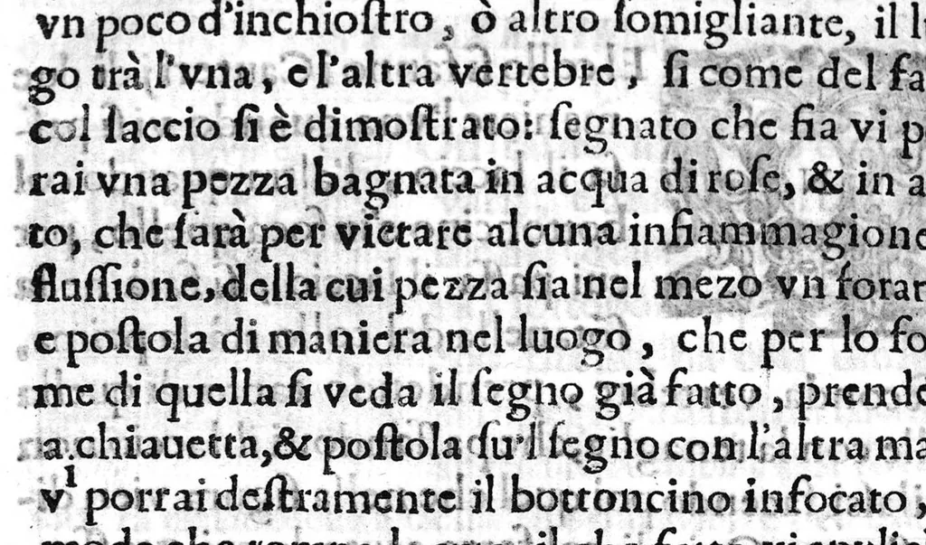 An illustration from Prattica nuova, et utilissima di tutto quello, ch' al diligente barbiero s'appartiene... ove si discorre del cavar sangue, medicar, ferite, et balsamar corpi humani..., 1671, leaf 121