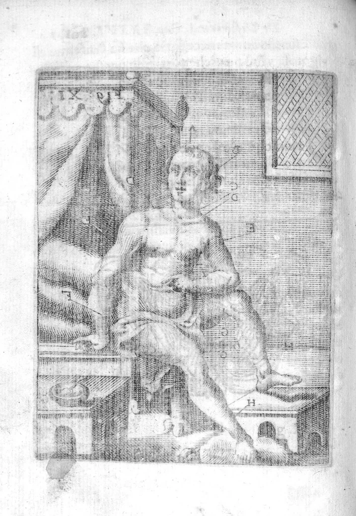 An illustration from Prattica nuova, et utilissima di tutto quello, ch' al diligente barbiero s'appartiene... ove si discorre del cavar sangue, medicar, ferite, et balsamar corpi humani..., 1671, leaf 133
