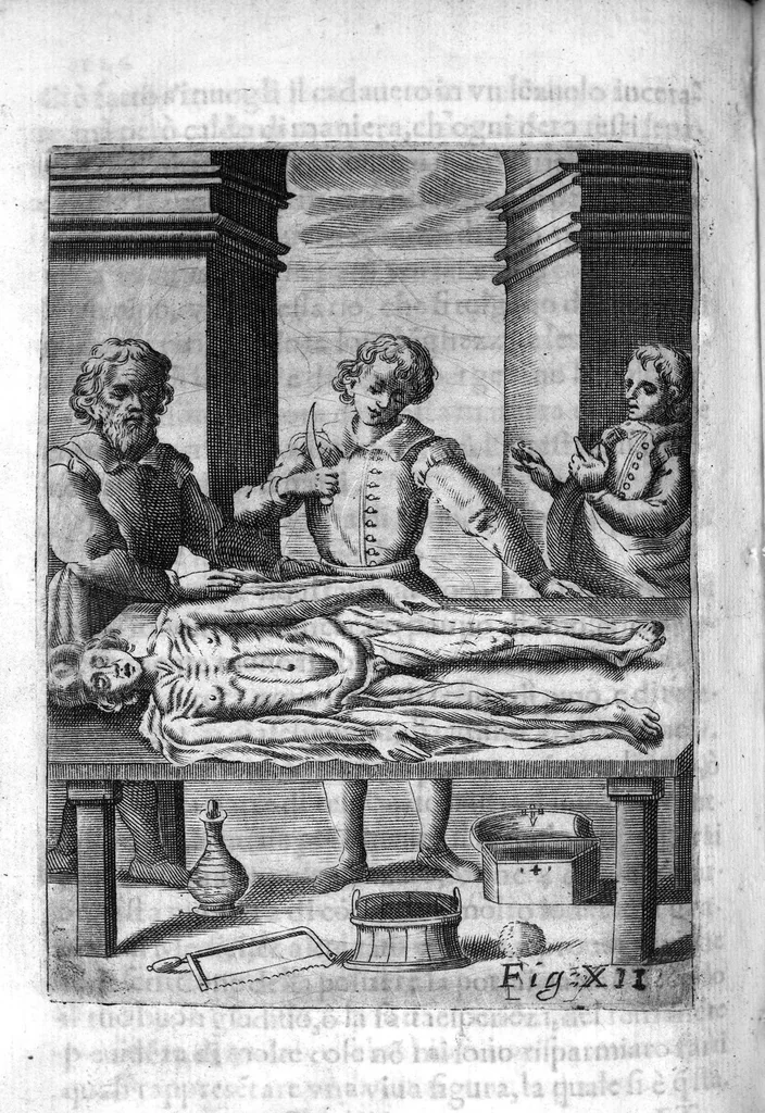 An illustration from Prattica nuova, et utilissima di tutto quello, ch' al diligente barbiero s'appartiene... ove si discorre del cavar sangue, medicar, ferite, et balsamar corpi humani..., 1671, leaf 159