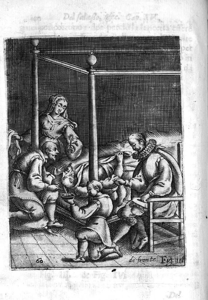 An illustration from Prattica nuova, et utilissima di tutto quello, ch' al diligente barbiero s'appartiene... ove si discorre del cavar sangue, medicar, ferite, et balsamar corpi humani..., 1671, leaf 57