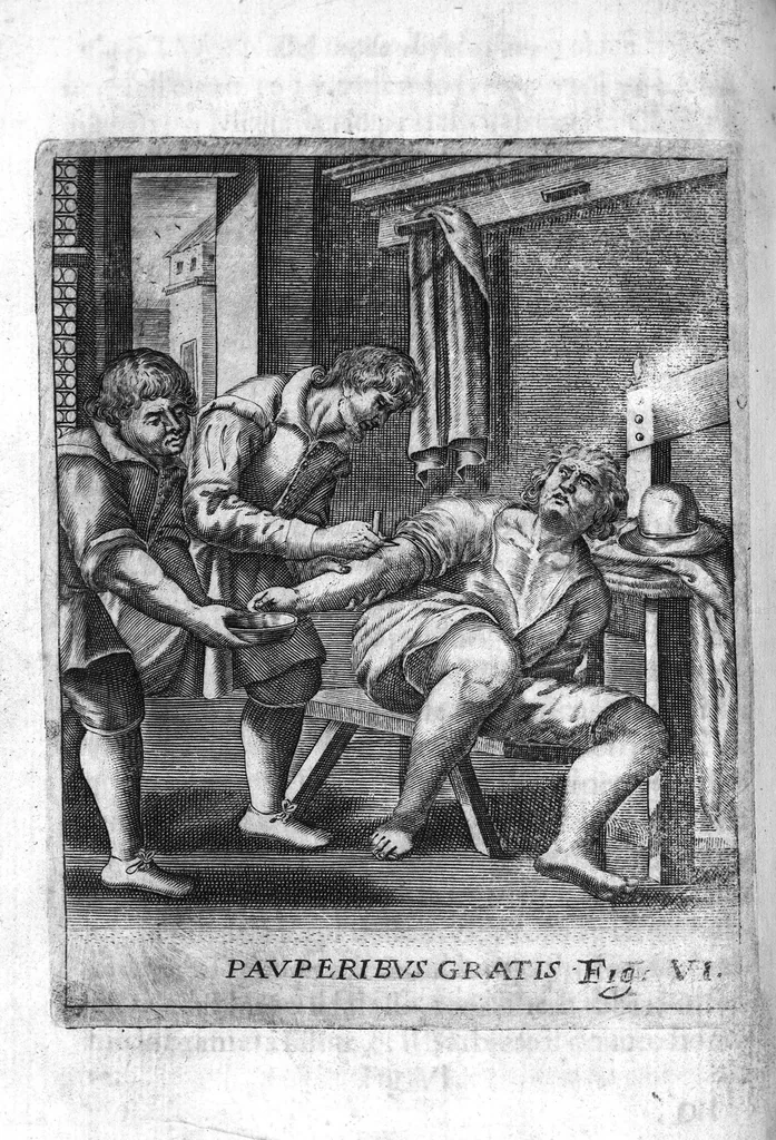 An illustration from Prattica nuova, et utilissima di tutto quello, ch' al diligente barbiero s'appartiene... ove si discorre del cavar sangue, medicar, ferite, et balsamar corpi humani..., 1671, leaf 73