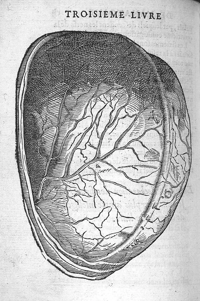 An illustration from Anatomie universelle du Corps humain, composee par A. Paré, Chirurgien ordinaire du Roy et Juré à Paris : reveue et augmentee par ledit autheur, avec I. Rostaing du Bignosc Provençal, aussi Chirurgien Juré à Paris, 1561, leaf 335