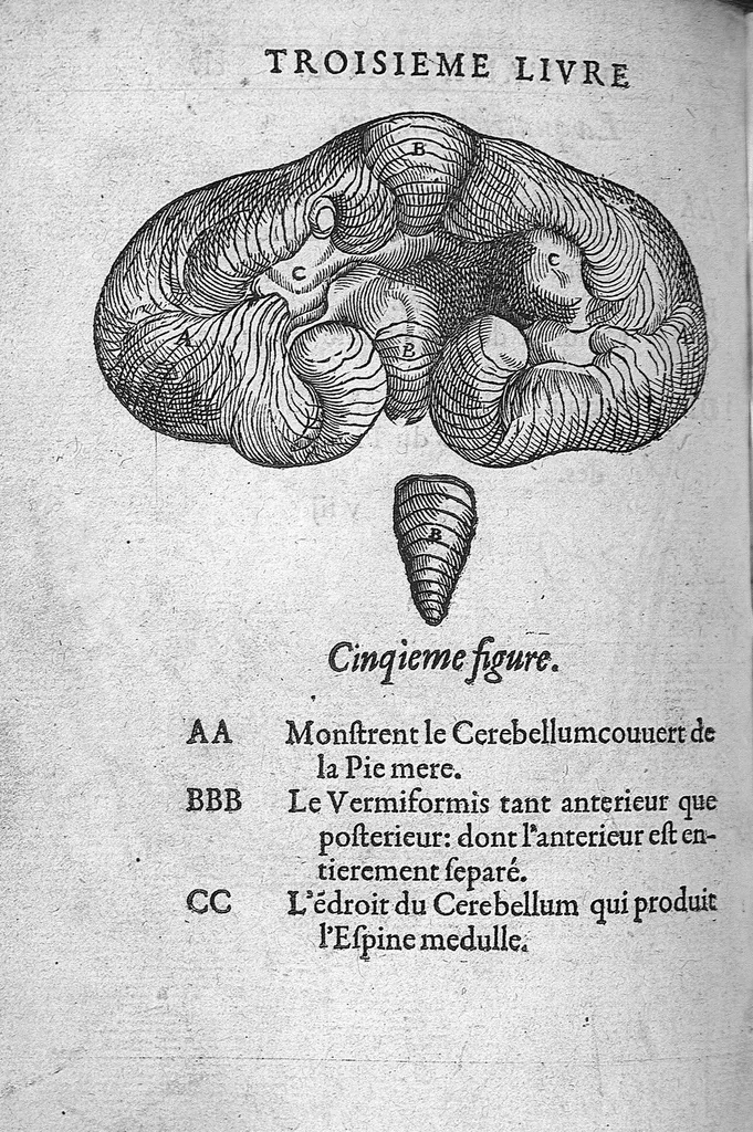 An illustration from Anatomie universelle du Corps humain, composee par A. Paré, Chirurgien ordinaire du Roy et Juré à Paris : reveue et augmentee par ledit autheur, avec I. Rostaing du Bignosc Provençal, aussi Chirurgien Juré à Paris, 1561, leaf 343