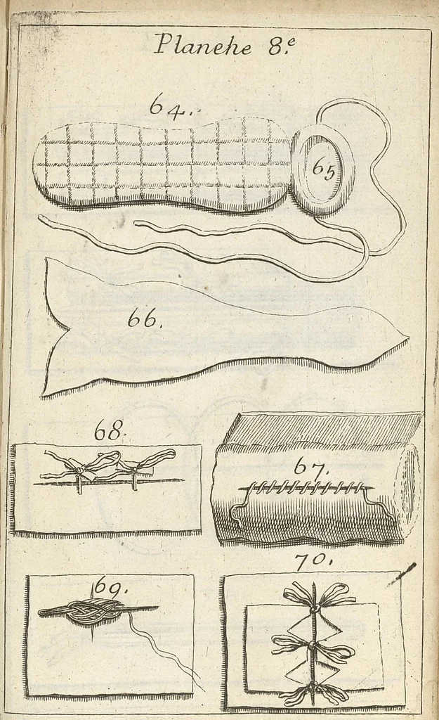 An illustration from Traité complet des operations de chirurgie : contenant leurs definitions, leurs causes expliquées sur la structure de la partie, les signes des maladies qui nous obligent de faire l'operation..., 1698, leaf 896