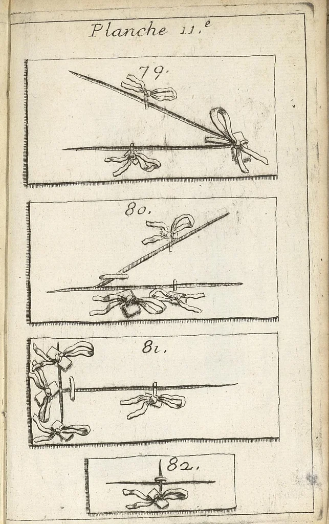 An illustration from Traité complet des operations de chirurgie : contenant leurs definitions, leurs causes expliquées sur la structure de la partie, les signes des maladies qui nous obligent de faire l'operation..., 1698, leaf 902