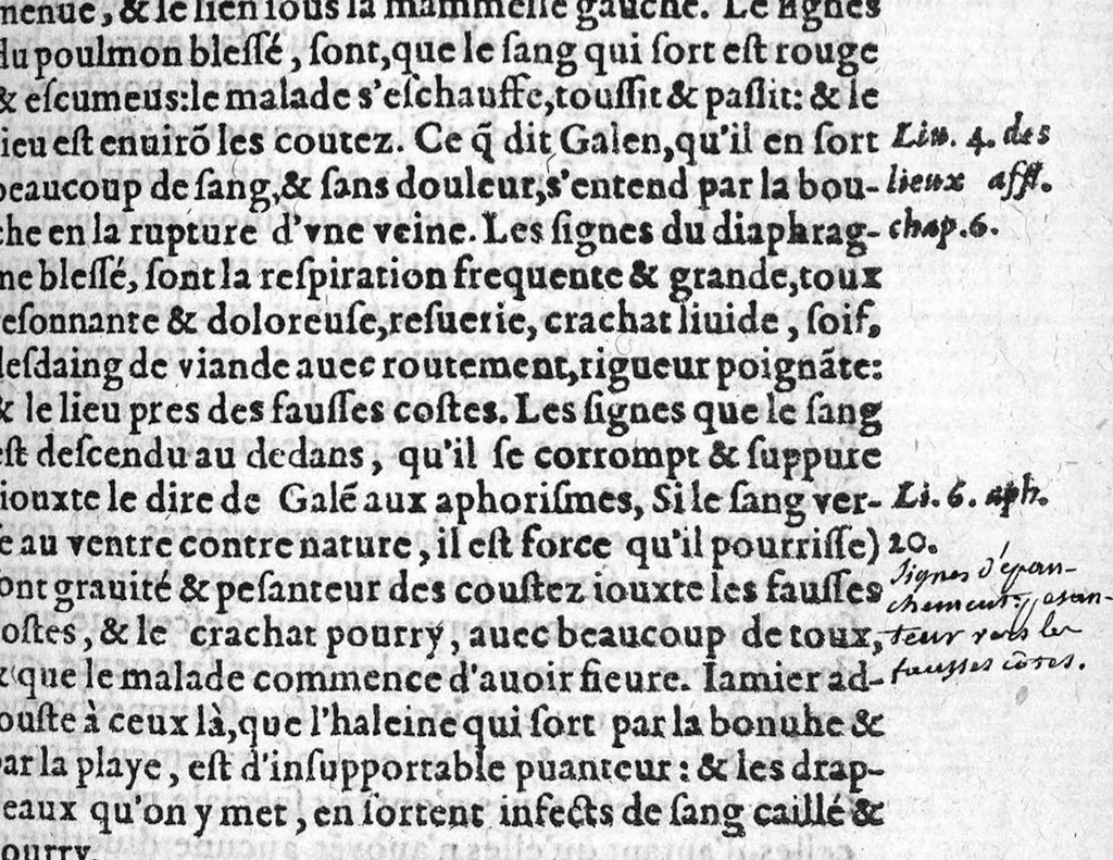 An illustration from La grande chirurgie de M. Gui de Chauliac, Medecin tres-fameux de l’Université de Monpelier, composee l’an de grace M.CCC.LXIII. Restituee nouvellement a sa dignité, par M. Laurens Joubert, Medecin ordinaire du Roy, et du Roy de Navarre, premier Docteur regent stipendié, Chancelier et Juge de ladicte Université. Voyez au prochain feuillet, ce que M. Joubert ha faict (outre sa nouvelle traduction) et fourny du sien, en recognoissant cest’ œuvre,, 1579, leaf 498