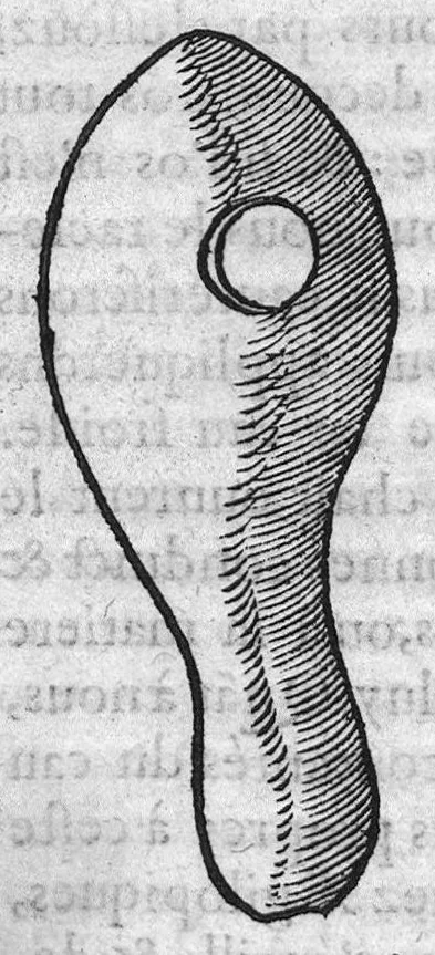 An illustration from Chirurgie françoise, recueillie par M. Jaques Dalechamps, Docteur Medicin, et Lecteur ordinaire de ceste profession à Lyon. Avec plusieurs figures des instrumens necessaires pour l’operation manuelle. La page 14. contient les principaux chefz de ce qui se discourt en cest œuvre,, 1569, leaf 157