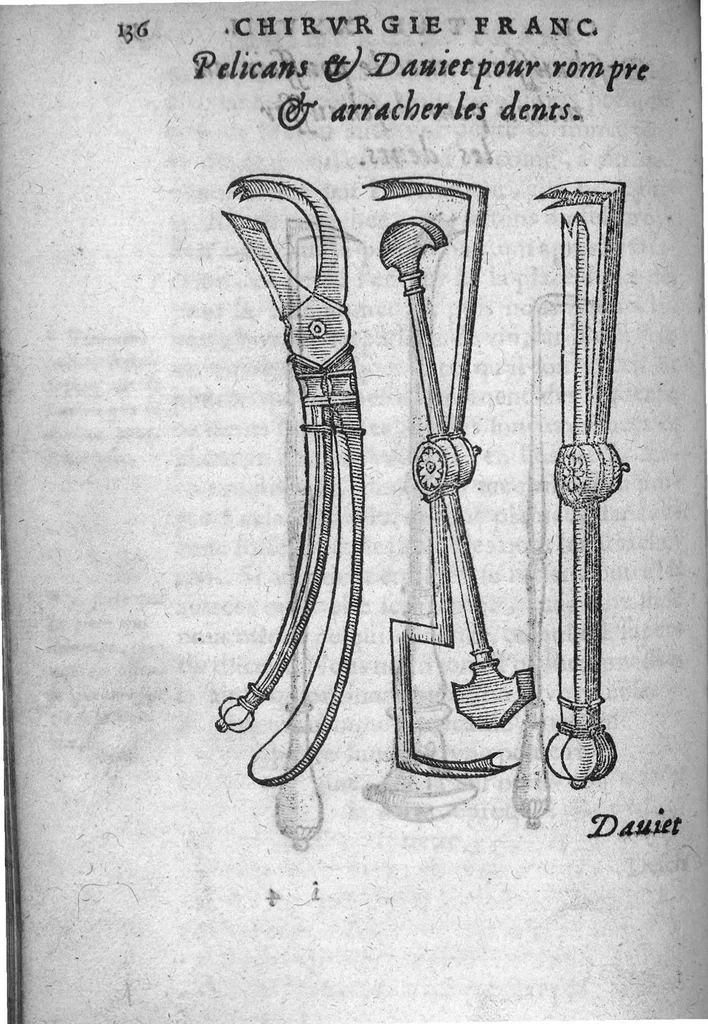 An illustration from Chirurgie françoise, recueillie par M. Jaques Dalechamps, Docteur Medicin, et Lecteur ordinaire de ceste profession à Lyon. Avec plusieurs figures des instrumens necessaires pour l’operation manuelle. La page 14. contient les principaux chefz de ce qui se discourt en cest œuvre,, 1569, leaf 187