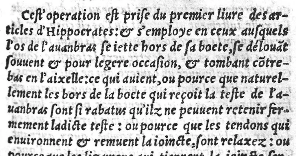 An illustration from Chirurgie françoise, recueillie par M. Jaques Dalechamps, Docteur Medicin, et Lecteur ordinaire de ceste profession à Lyon. Avec plusieurs figures des instrumens necessaires pour l’operation manuelle. La page 14. contient les principaux chefz de ce qui se discourt en cest œuvre,, 1569, leaf 296