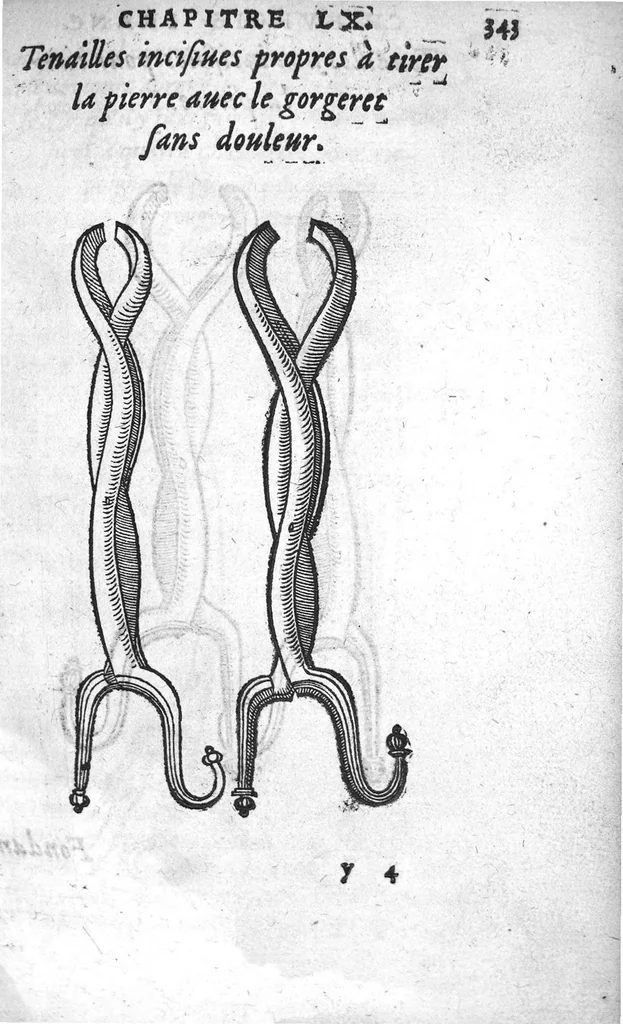 An illustration from Chirurgie françoise, recueillie par M. Jaques Dalechamps, Docteur Medicin, et Lecteur ordinaire de ceste profession à Lyon. Avec plusieurs figures des instrumens necessaires pour l’operation manuelle. La page 14. contient les principaux chefz de ce qui se discourt en cest œuvre,, 1569, leaf 394
