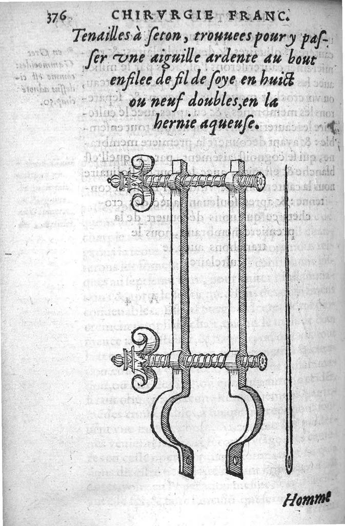 An illustration from Chirurgie françoise, recueillie par M. Jaques Dalechamps, Docteur Medicin, et Lecteur ordinaire de ceste profession à Lyon. Avec plusieurs figures des instrumens necessaires pour l’operation manuelle. La page 14. contient les principaux chefz de ce qui se discourt en cest œuvre,, 1569, leaf 427