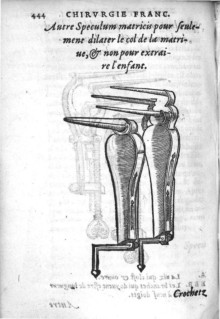 An illustration from Chirurgie françoise, recueillie par M. Jaques Dalechamps, Docteur Medicin, et Lecteur ordinaire de ceste profession à Lyon. Avec plusieurs figures des instrumens necessaires pour l’operation manuelle. La page 14. contient les principaux chefz de ce qui se discourt en cest œuvre,, 1569, leaf 495