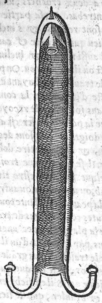 An illustration from Chirurgie françoise, recueillie par M. Jaques Dalechamps, Docteur Medicin, et Lecteur ordinaire de ceste profession à Lyon. Avec plusieurs figures des instrumens necessaires pour l’operation manuelle. La page 14. contient les principaux chefz de ce qui se discourt en cest œuvre,, 1569, leaf 650