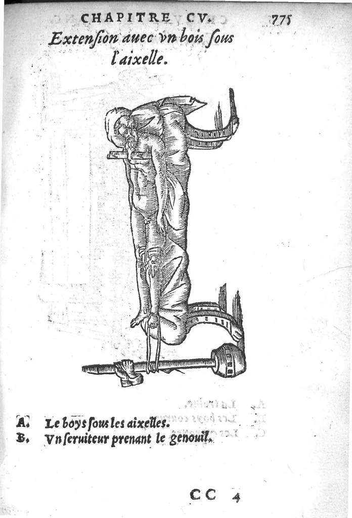 An illustration from Chirurgie françoise, recueillie par M. Jaques Dalechamps, Docteur Medicin, et Lecteur ordinaire de ceste profession à Lyon. Avec plusieurs figures des instrumens necessaires pour l’operation manuelle. La page 14. contient les principaux chefz de ce qui se discourt en cest œuvre,, 1569, leaf 826
