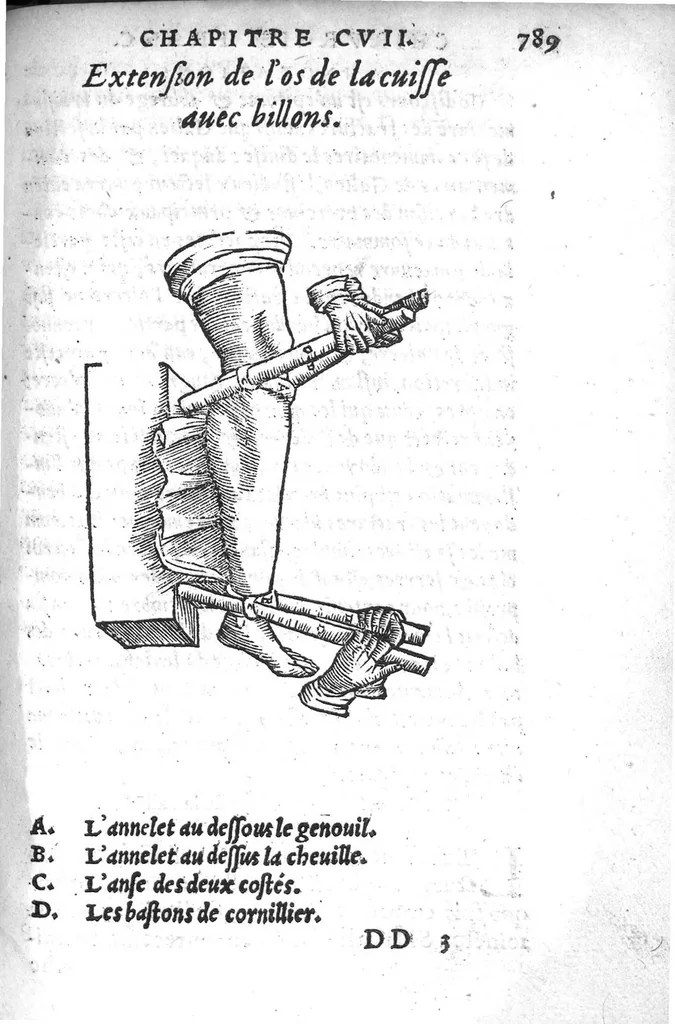 An illustration from Chirurgie françoise, recueillie par M. Jaques Dalechamps, Docteur Medicin, et Lecteur ordinaire de ceste profession à Lyon. Avec plusieurs figures des instrumens necessaires pour l’operation manuelle. La page 14. contient les principaux chefz de ce qui se discourt en cest œuvre,, 1569, leaf 840