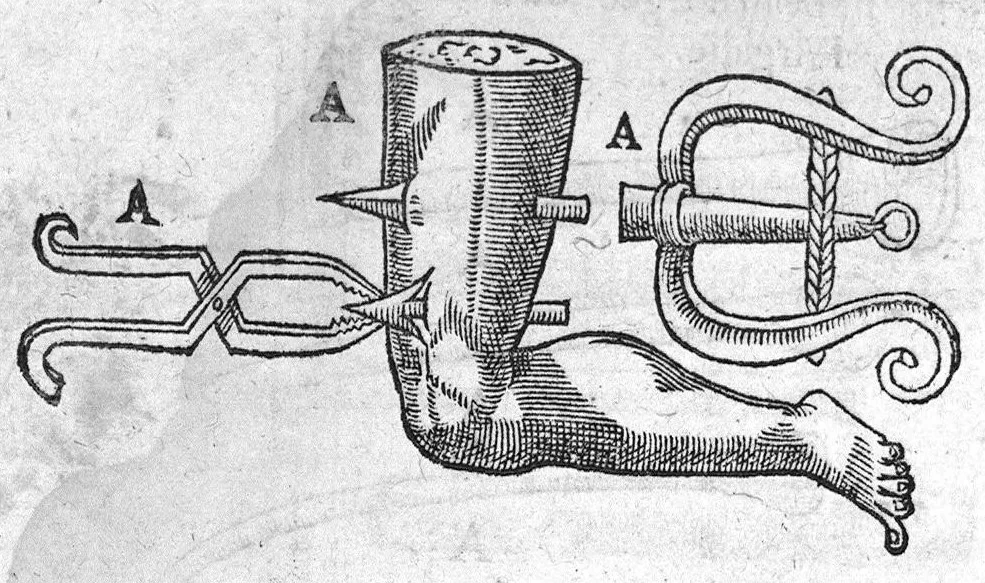 An illustration from La grande chirurgie de M. Gui de Chauliac, Medecin tres-fameux de l’Université de Montpellier, composée l’an de grace 1363. Restituee nouvellement a sa dignité, par M. Laurens Joubert, Medecin ordinaire du Roy, et du Roy de Navarre, premier Docteur regent stipendié, chancelier et Juge de ladicte Université. Voyez au prochain feuillet, ce que M. Joubert à faict (outre sa nouvelle traduction) et fourny du sien, en recognoissant cest’ œuvre, 1592, leaf 1264