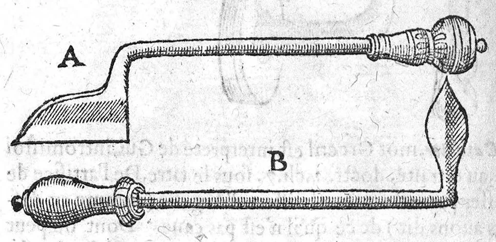 An illustration from La grande chirurgie de M. Gui de Chauliac, Medecin tres-fameux de l’Université de Montpellier, composée l’an de grace 1363. Restituee nouvellement a sa dignité, par M. Laurens Joubert, Medecin ordinaire du Roy, et du Roy de Navarre, premier Docteur regent stipendié, chancelier et Juge de ladicte Université. Voyez au prochain feuillet, ce que M. Joubert à faict (outre sa nouvelle traduction) et fourny du sien, en recognoissant cest’ œuvre, 1592, leaf 1271