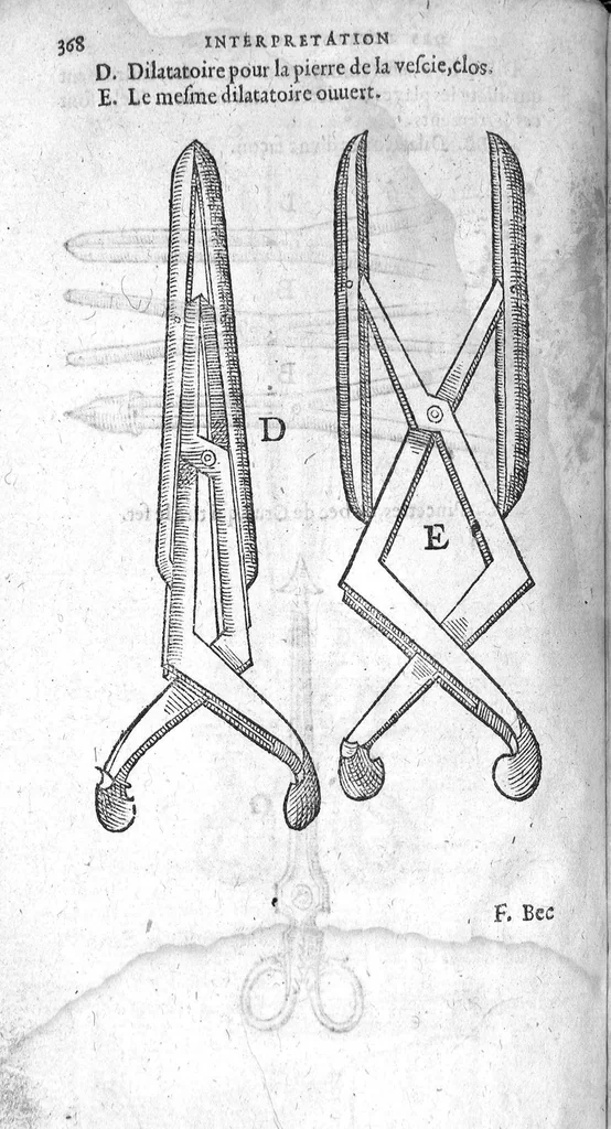 An illustration from La grande chirurgie de M. Gui de Chauliac, Medecin tres-fameux de l’Université de Montpellier, composée l’an de grace 1363. Restituee nouvellement a sa dignité, par M. Laurens Joubert, Medecin ordinaire du Roy, et du Roy de Navarre, premier Docteur regent stipendié, chancelier et Juge de ladicte Université. Voyez au prochain feuillet, ce que M. Joubert à faict (outre sa nouvelle traduction) et fourny du sien, en recognoissant cest’ œuvre, 1592, leaf 1277