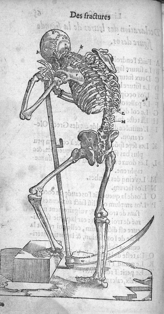 An illustration from Dix livres de la chirurgie avec le Magasin des Instrumens necessaires à icelle. Par Ambroise Paré, premier Chirurgien du Roy et juré à Paris, 1564, leaf 178