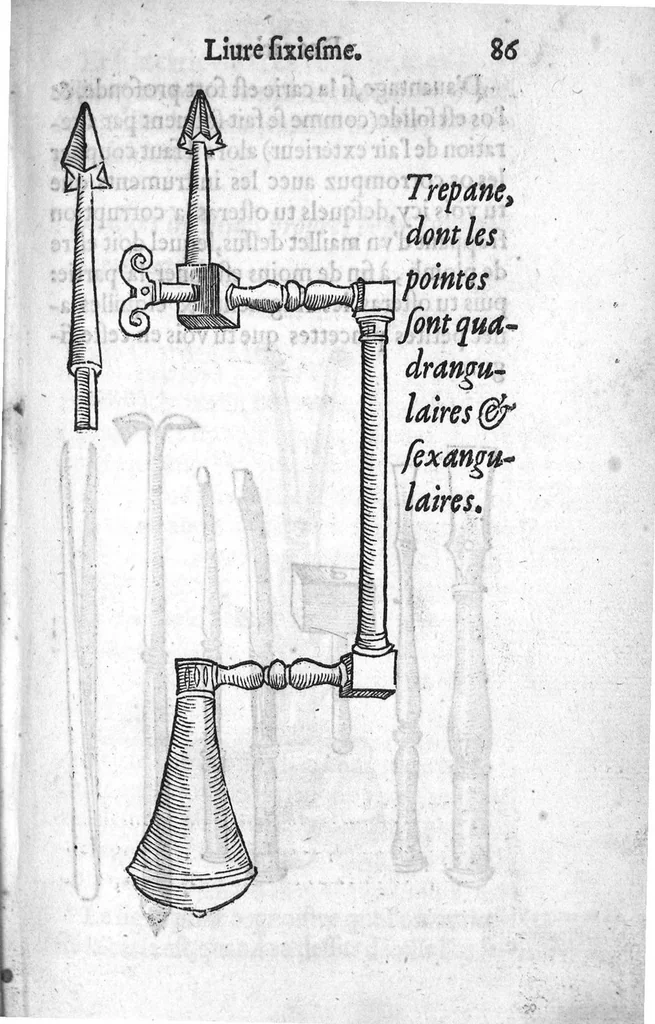 An illustration from Dix livres de la chirurgie avec le Magasin des Instrumens necessaires à icelle. Par Ambroise Paré, premier Chirurgien du Roy et juré à Paris, 1564, leaf 223