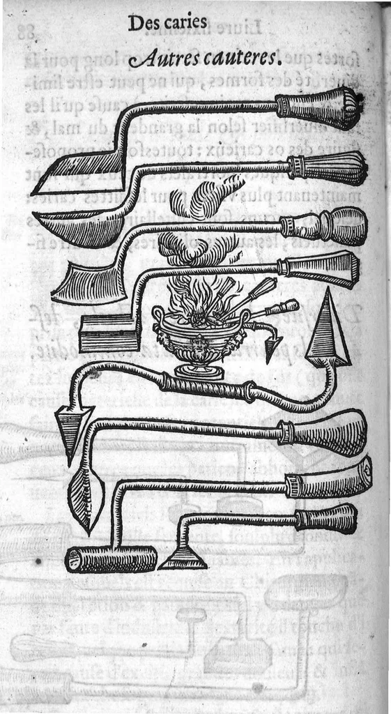 An illustration from Dix livres de la chirurgie avec le Magasin des Instrumens necessaires à icelle. Par Ambroise Paré, premier Chirurgien du Roy et juré à Paris, 1564, leaf 228