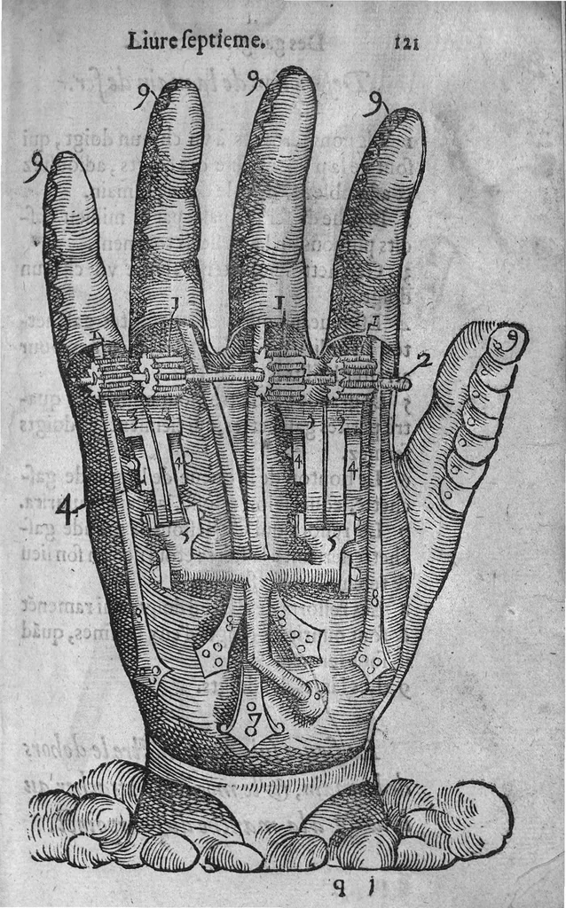 An illustration from Dix livres de la chirurgie avec le Magasin des Instrumens necessaires à icelle. Par Ambroise Paré, premier Chirurgien du Roy et juré à Paris, 1564, leaf 293