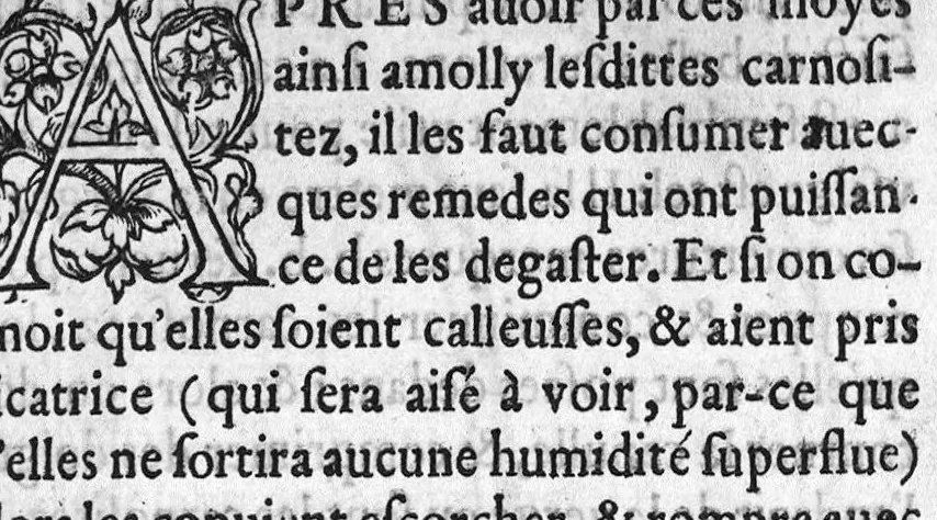 An illustration from Dix livres de la chirurgie avec le Magasin des Instrumens necessaires à icelle. Par Ambroise Paré, premier Chirurgien du Roy et juré à Paris, 1564, leaf 339
