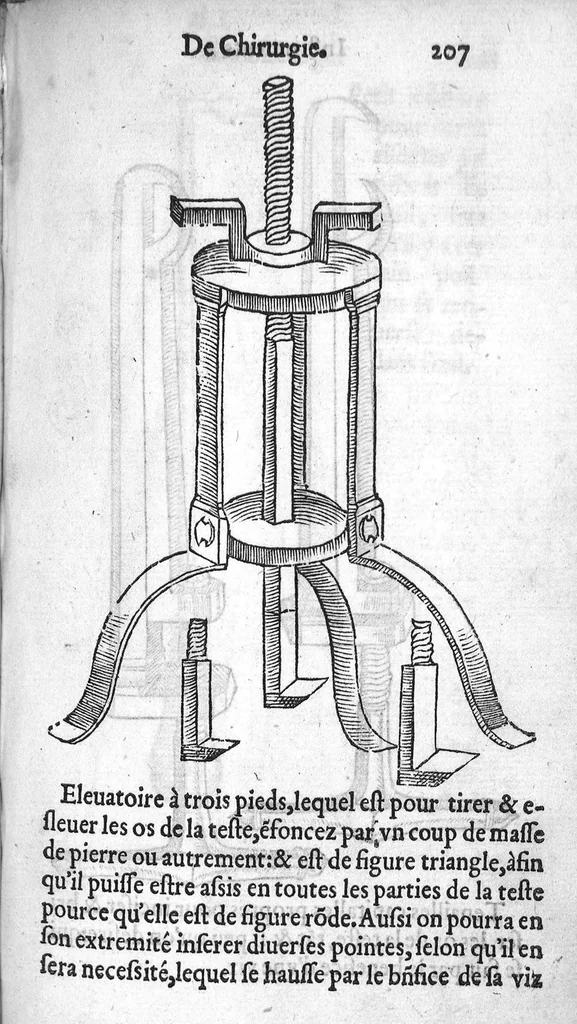 An illustration from Dix livres de la chirurgie avec le Magasin des Instrumens necessaires à icelle. Par Ambroise Paré, premier Chirurgien du Roy et juré à Paris, 1564, leaf 465