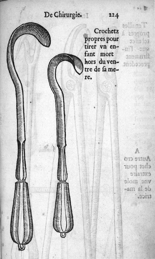 An illustration from Dix livres de la chirurgie avec le Magasin des Instrumens necessaires à icelle. Par Ambroise Paré, premier Chirurgien du Roy et juré à Paris, 1564, leaf 499