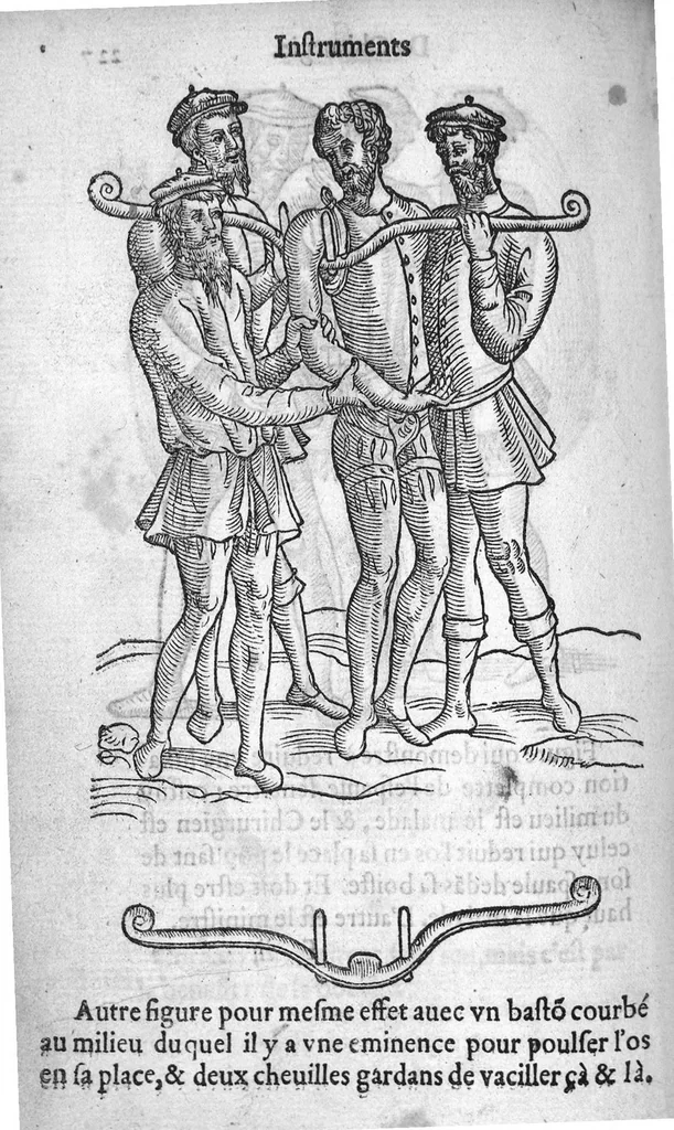 An illustration from Dix livres de la chirurgie avec le Magasin des Instrumens necessaires à icelle. Par Ambroise Paré, premier Chirurgien du Roy et juré à Paris, 1564, leaf 506