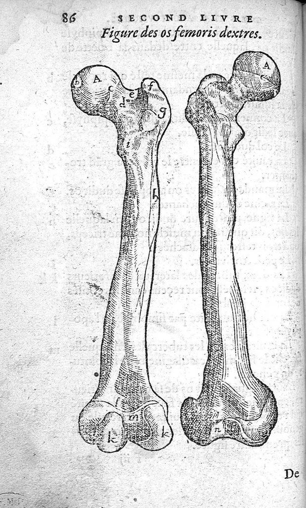 An illustration from Cinq livres de chirurgie. I. Des bandages 2. Des fractures. 3. Des luxations, avec une Apologie touchant les harquebousades. 4. Des morsures et piqueures venimeuses. 5. Des gouttes. Par Ambroise Paré, premier Chirurgien du Roy et juré à Paris,, 1572, leaf 109