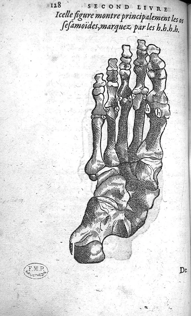 An illustration from Cinq livres de chirurgie. I. Des bandages 2. Des fractures. 3. Des luxations, avec une Apologie touchant les harquebousades. 4. Des morsures et piqueures venimeuses. 5. Des gouttes. Par Ambroise Paré, premier Chirurgien du Roy et juré à Paris,, 1572, leaf 151