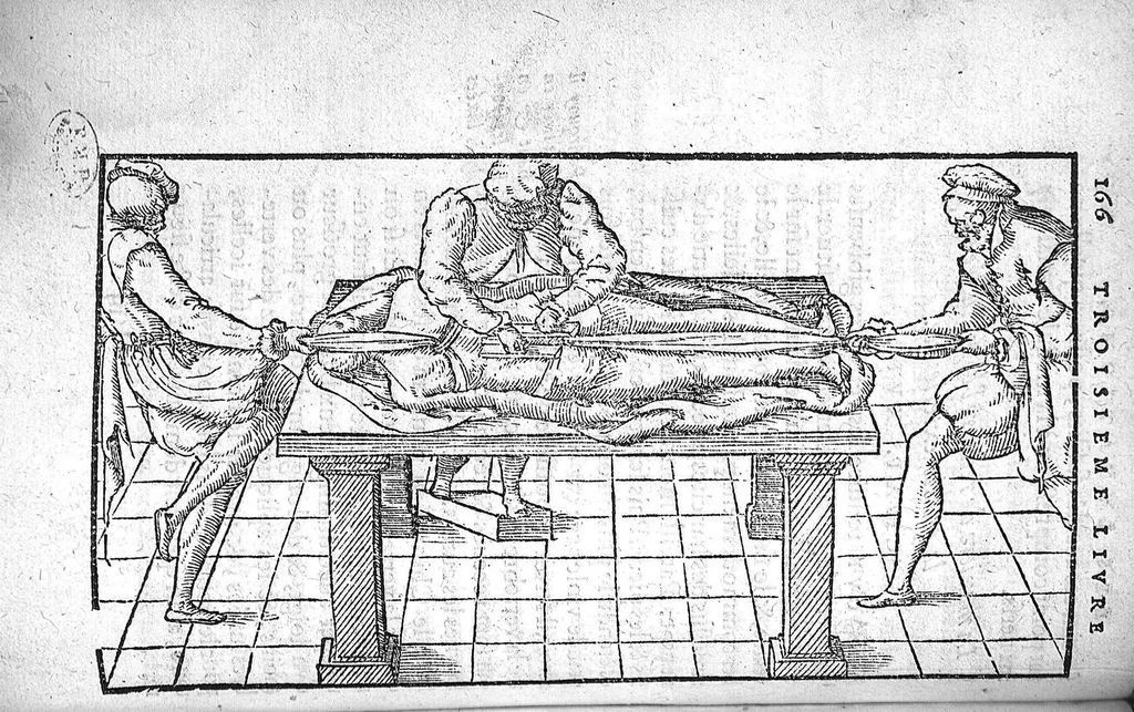 An illustration from Cinq livres de chirurgie. I. Des bandages 2. Des fractures. 3. Des luxations, avec une Apologie touchant les harquebousades. 4. Des morsures et piqueures venimeuses. 5. Des gouttes. Par Ambroise Paré, premier Chirurgien du Roy et juré à Paris,, 1572, leaf 189