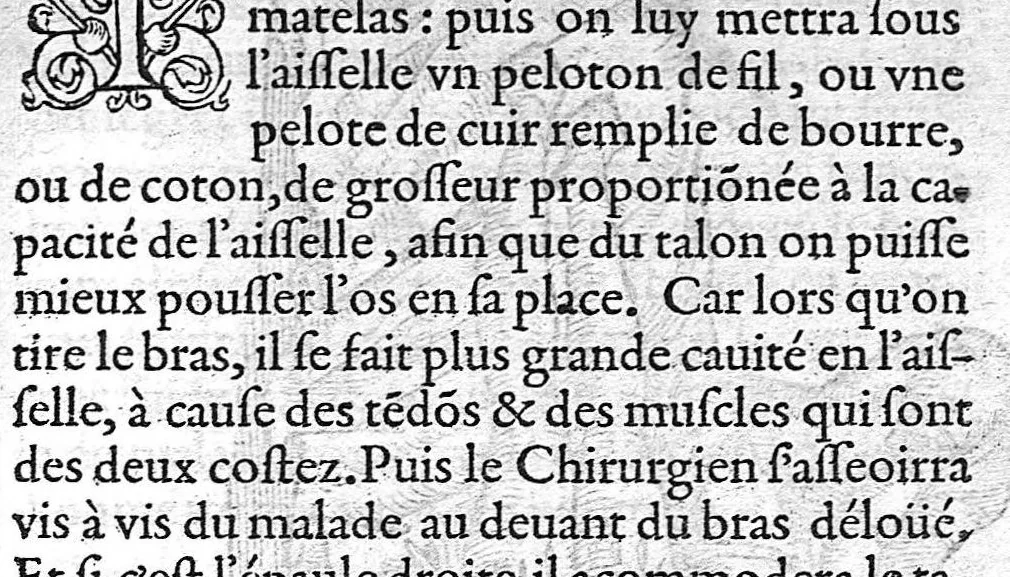 An illustration from Cinq livres de chirurgie. I. Des bandages 2. Des fractures. 3. Des luxations, avec une Apologie touchant les harquebousades. 4. Des morsures et piqueures venimeuses. 5. Des gouttes. Par Ambroise Paré, premier Chirurgien du Roy et juré à Paris,, 1572, leaf 204