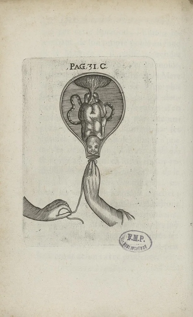 An illustration from Le chemin frayé et infaillible aux accouchemens, qui servira de flambeau aux sages-femmes, pour les éclairer en leurs operations, cachées dans les plus obscures cavernes de la matrice. Le tout enrichi de diverses figures..., 1689, leaf 51