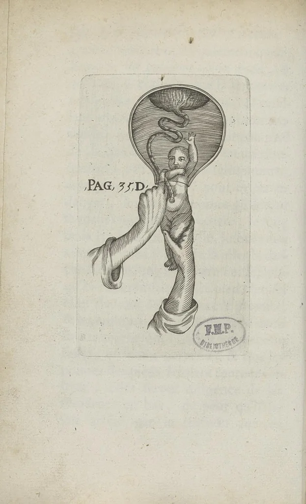 An illustration from Le chemin frayé et infaillible aux accouchemens, qui servira de flambeau aux sages-femmes, pour les éclairer en leurs operations, cachées dans les plus obscures cavernes de la matrice. Le tout enrichi de diverses figures..., 1689, leaf 57