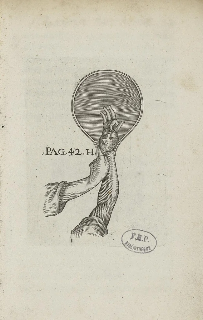 An illustration from Le chemin frayé et infaillible aux accouchemens, qui servira de flambeau aux sages-femmes, pour les éclairer en leurs operations, cachées dans les plus obscures cavernes de la matrice. Le tout enrichi de diverses figures..., 1689, leaf 72