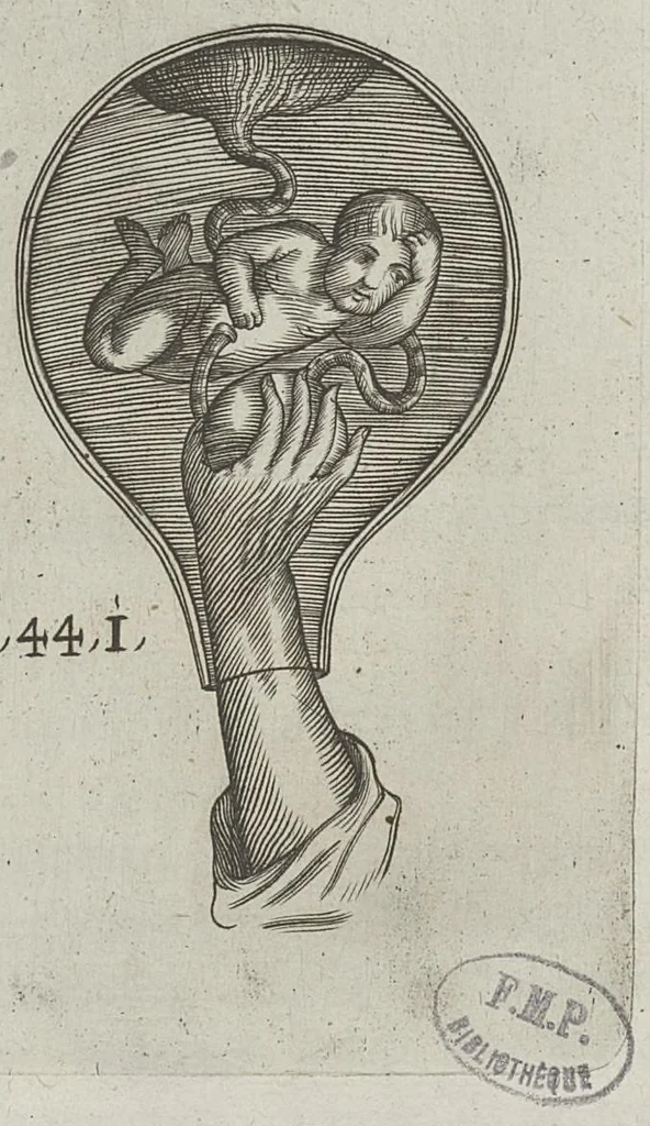 An illustration from Le chemin frayé et infaillible aux accouchemens, qui servira de flambeau aux sages-femmes, pour les éclairer en leurs operations, cachées dans les plus obscures cavernes de la matrice. Le tout enrichi de diverses figures..., 1689, leaf 76