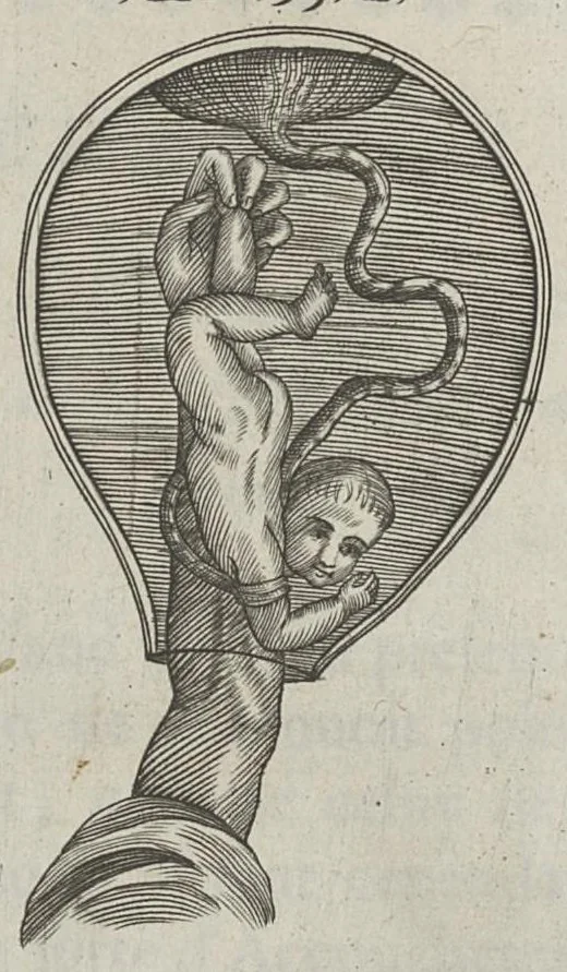 An illustration from Le chemin frayé et infaillible aux accouchemens, qui servira de flambeau aux sages-femmes, pour les éclairer en leurs operations, cachées dans les plus obscures cavernes de la matrice. Le tout enrichi de diverses figures..., 1689, leaf 93