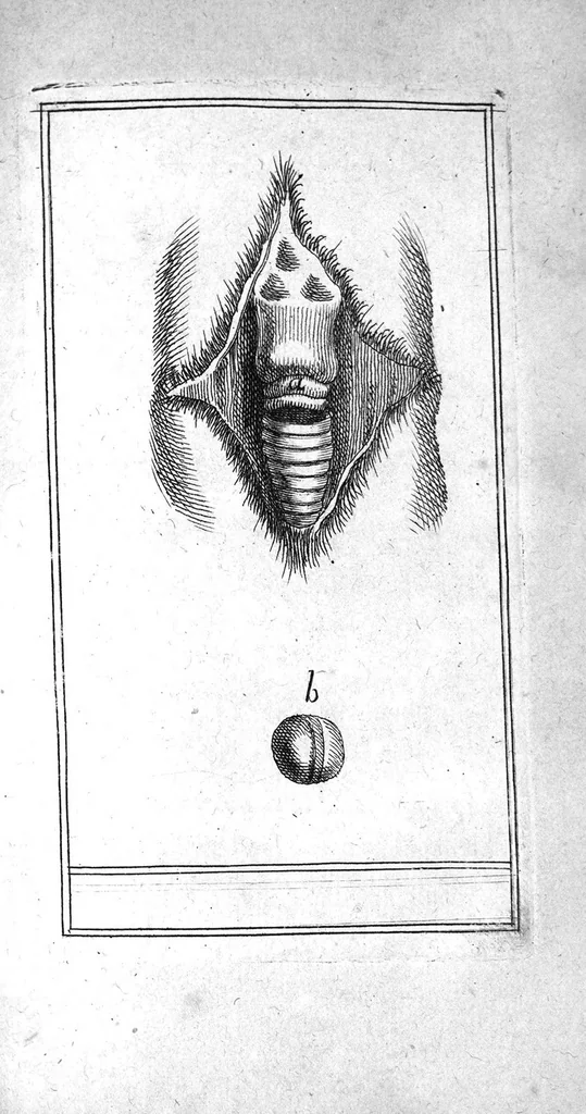 An illustration from Journal de médecine, ou Observations des plus fameux médecins, chirurgiens et anatomistes de l'Europe, tirées des journaux des pays étrangers, et autres mémoires particuliers, 1686, leaf 60