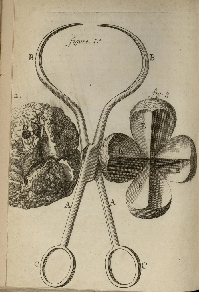 An illustration from Lettre de Monsieur Helvetius...sur la nature et la guerison du cancer, 1691, leaf 15