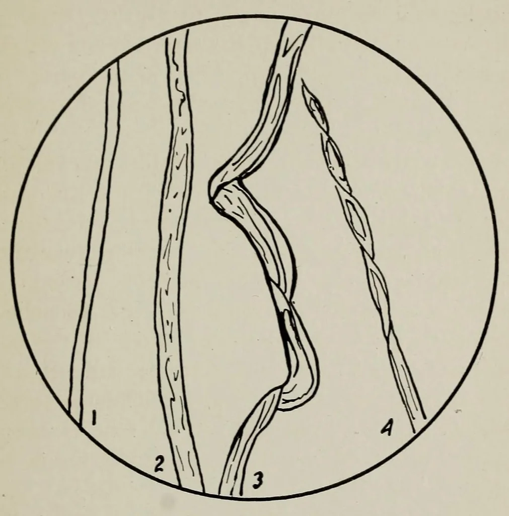 An illustration from Sewing and textiles; a textbook for grades and rural schools, prepared in the Extension division of the University of Wisconsin, 1918, leaf 51