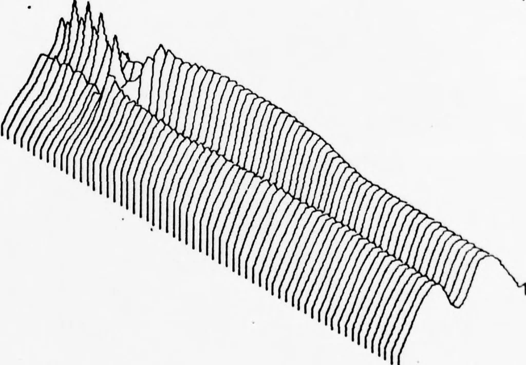 An illustration from An Application of Computer Graphics: Two Concurrent Investigations Within the Medical Field,, 1971, leaf 132