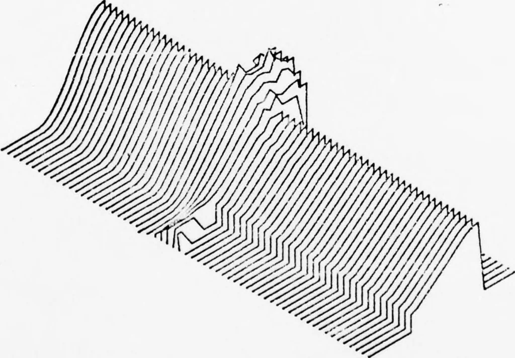 An illustration from An Application of Computer Graphics: Two Concurrent Investigations Within the Medical Field,, 1971, leaf 186