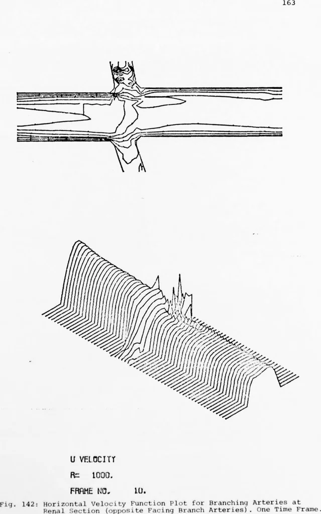 An illustration from An Application of Computer Graphics: Two Concurrent Investigations Within the Medical Field,, 1971, leaf 187