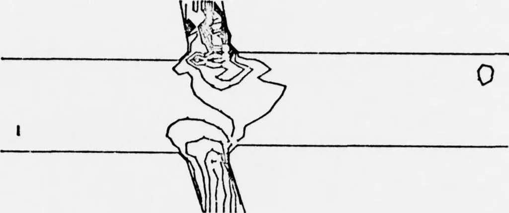 An illustration from An Application of Computer Graphics: Two Concurrent Investigations Within the Medical Field,, 1971, leaf 188