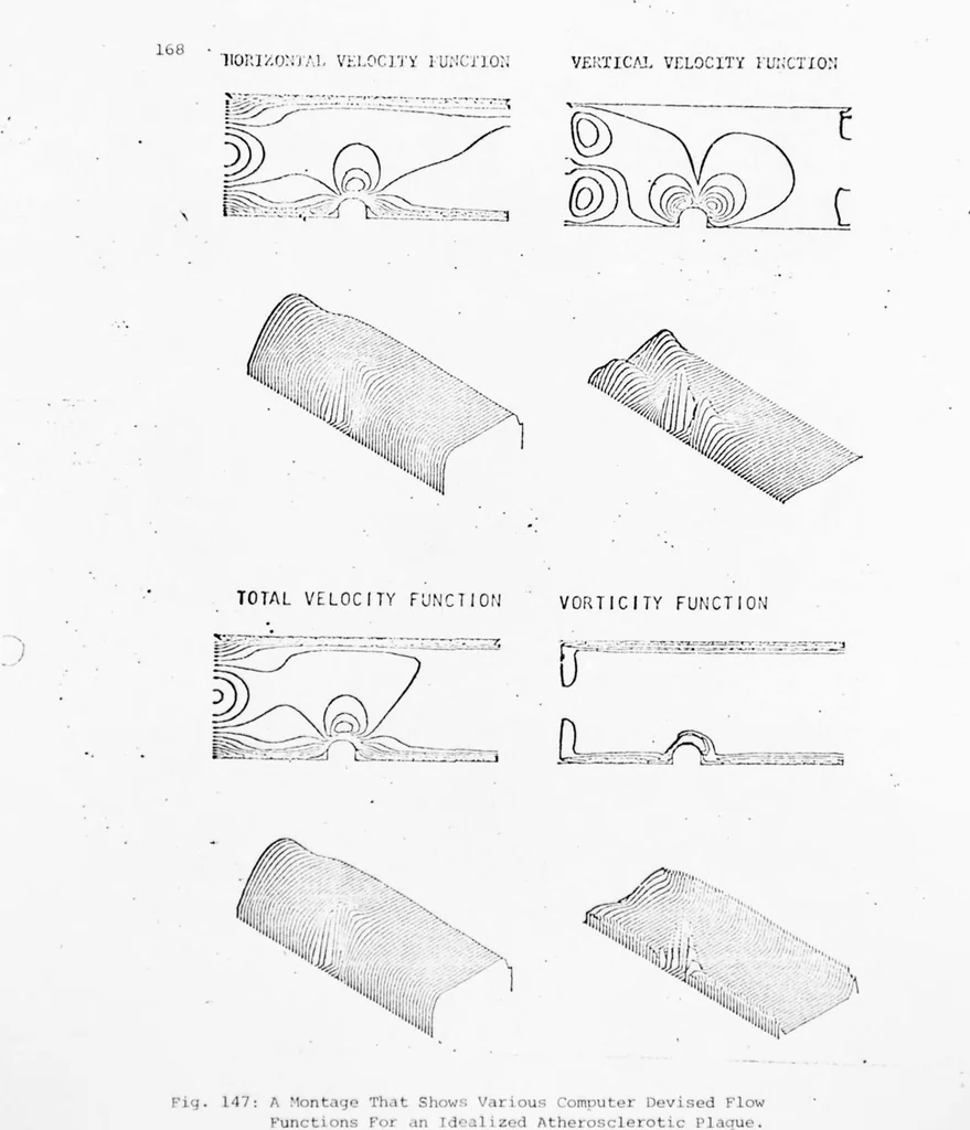 An illustration from An Application of Computer Graphics: Two Concurrent Investigations Within the Medical Field,, 1971, leaf 192