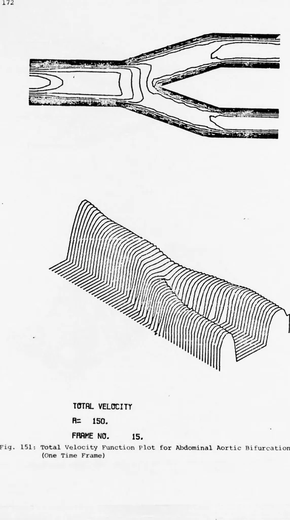 An illustration from An Application of Computer Graphics: Two Concurrent Investigations Within the Medical Field,, 1971, leaf 197