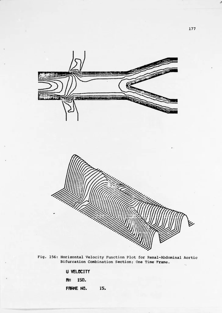 An illustration from An Application of Computer Graphics: Two Concurrent Investigations Within the Medical Field,, 1971, leaf 202